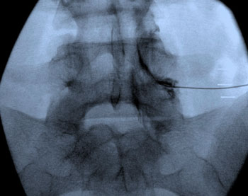 schmerztherapie_350