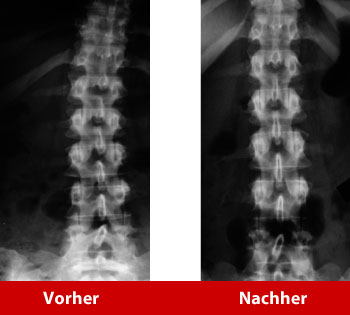 skol-vorher-nacher_350